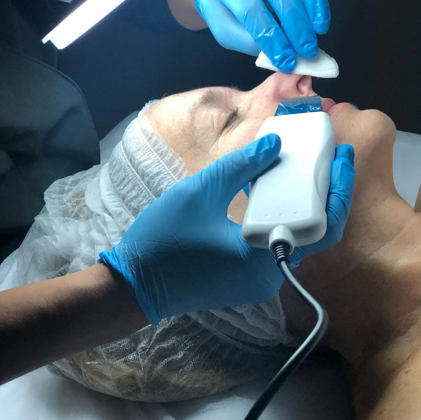 Tratamiento facial